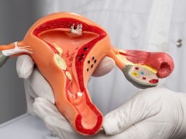 Vaginal Hysterectomy